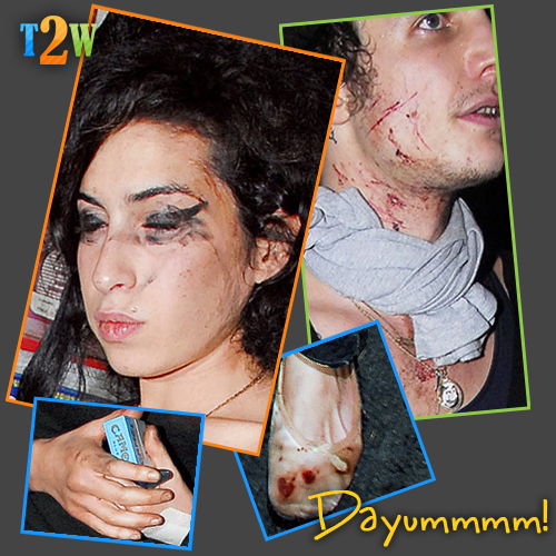 Amy Winehouse and Her Husband Beat the Shit Out of Each Other!